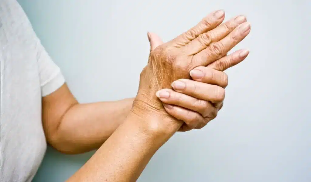 Artrose nas Mãos
