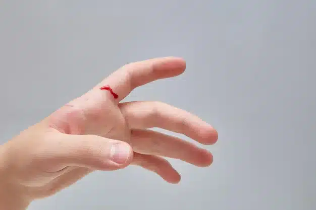 Cortes nas Mãos - Lesão de tendões ou nervos